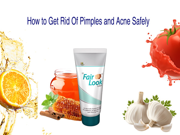 How to Get Rid Of Pimples and Acne Safely