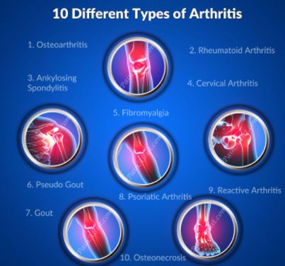 Types Of Arthritis and remedies